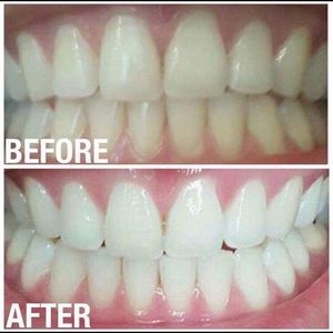 Other - Tooth whitening paste Other - Tooth whitening paste